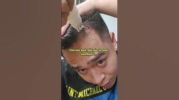 Lăn Mọc Tóc Hairborn Chính Hãng