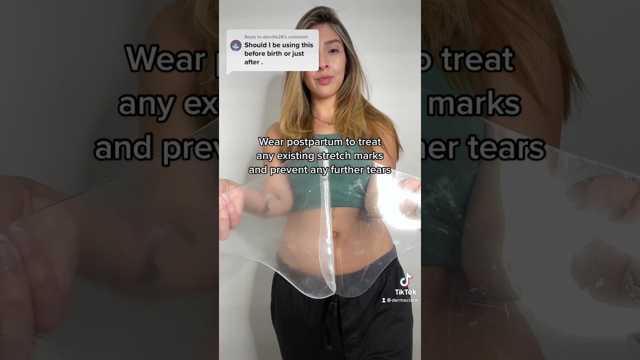 Prevent stretch marks during your pregnancy ????