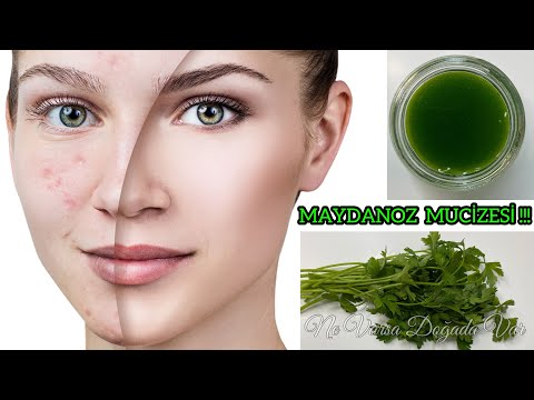 Make Parsley Cream, Get Flawless, Spotless Skin, Remove All Facial Spots and Wrinkles!