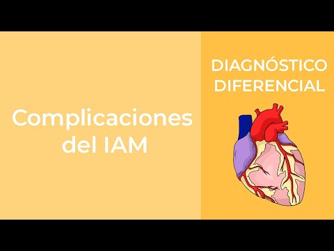 Vídeo: Complicaciones Del Infarto De Miocardio: Tempranas Y Tardías, Por Períodos