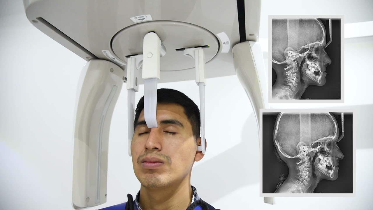🔥 PAX-I SC - Modo Cefalométrico 🔥
