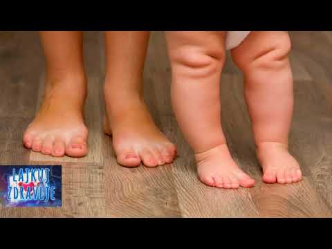 Lajkuj Zdravlje e015 - Cesti ortopedski problemi u toku razvoja dece