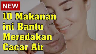 10 Makanan Ini Bantu Meredakan Cacar Air