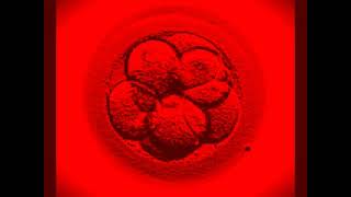 PINK FLOYD - THE EMBRYO (SUITE VERSION)