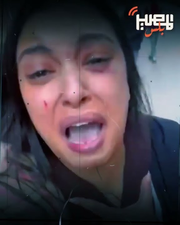 He dragged her and humiliated her all over the street... What happened between a man and a woman ...