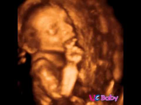 UC BABY - Example 3D 4D Ultrasound Video #152