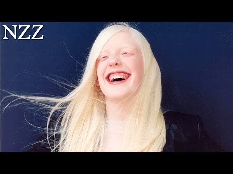 Albinos - Dokumentation von NZZ Format (2005)