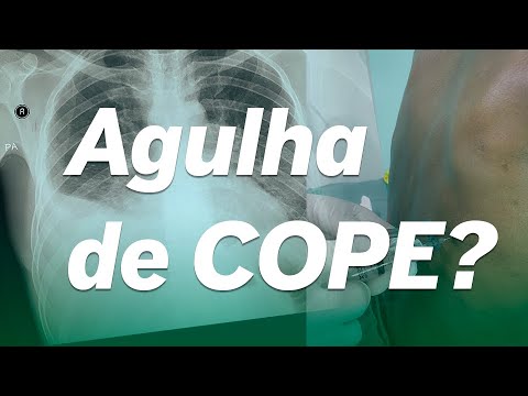 Toracocentesis + Pleura Biopsy with COPE Needle