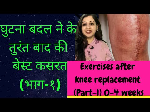 Physiotherapy after knee replcament घुटना बदलने के बाद क्या कसरत करे ?