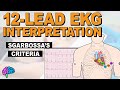12 Lead EKG Series Quiz