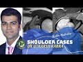 Shoulder Cases by Dr Utkarsh Kabra | MRI Quiz | Shoulder Instability | ALPSA | GAGL | AC Dislocation