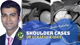 Shoulder Cases by Dr Utkarsh Kabra | MRI Quiz | Shoulder Instability | ALPSA | GAGL | AC Dislocation