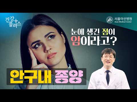눈에 생긴 점이 암이라고? 안구내 종양🧐| 건강플러스🏥