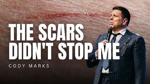 Cody Marks - THE SCARS DIDN