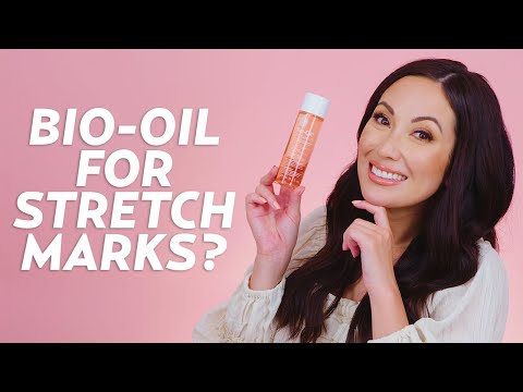 Video: Bepanthen Stretch Mark Cream Review