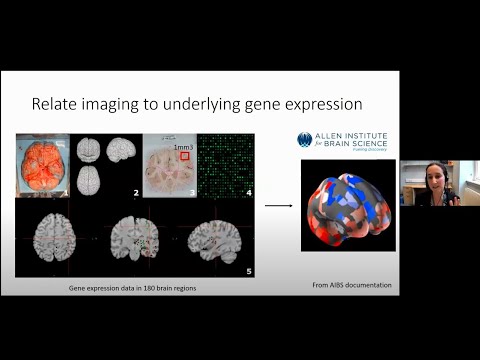 Using vision to understand dementia in Parkinson's disease recording thumbnail