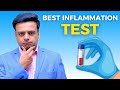 What is best inflammation blood test