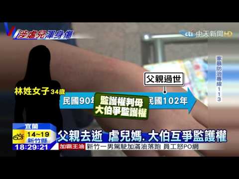 20150313中天新聞　狠心媽！尖嘴鉗夾肉　向警稱：管教兒子