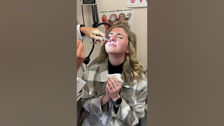 Splint removal after septoplasty!
