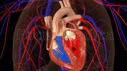 Atrial Fibrillation - Animated Atlas of Atrial Fibrillation