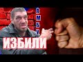 ЛюдиУблюди АМБА постадал | ЖЁСКО | ПОЛНЫЙ ТРЕШ!!!