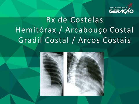 Radiografia das Costelas
