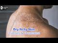 Dry itchy skin all over body. Causes, Diagnosis, Treatment - Dr. Rashmi Ravindra  | Doctors' Circle