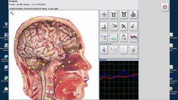 Bioresonance Classes and Certifications ISHA MIRACLE SPIRITUAL SCAN AND HEALING   NO DNA   NO CLIENT