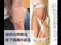 皮膚が硬くてかゆい時の原因と改善法