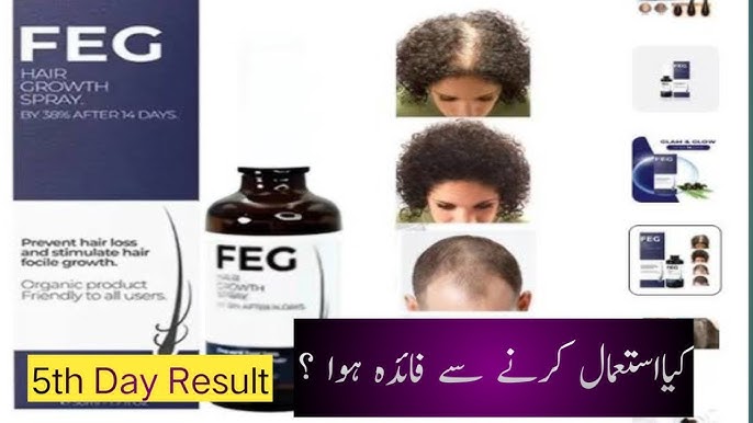 FEG Plus Hair Grow Spray ka istamal k baad result | Mohsin Salamat ...