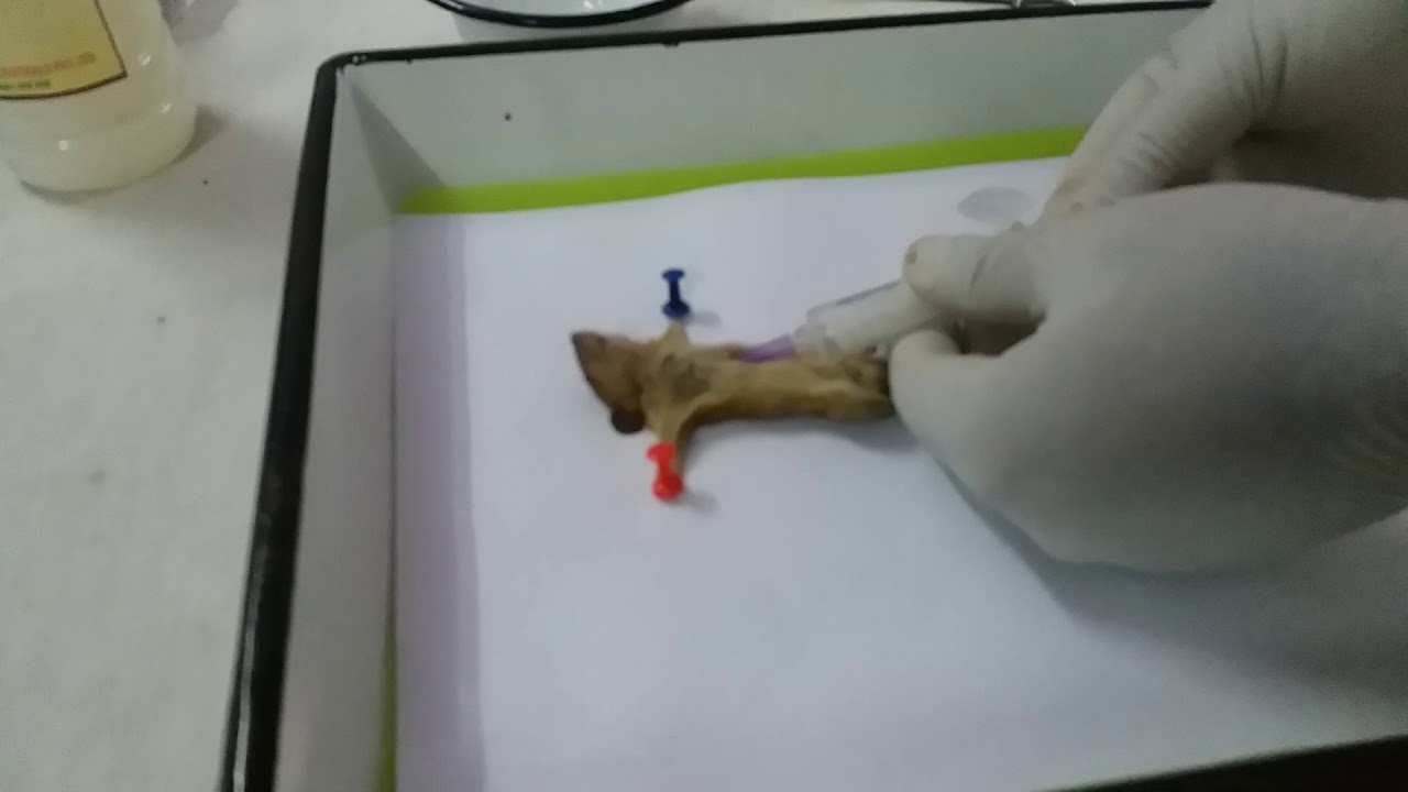 ⁣Scrub typhus Disease Ratlam