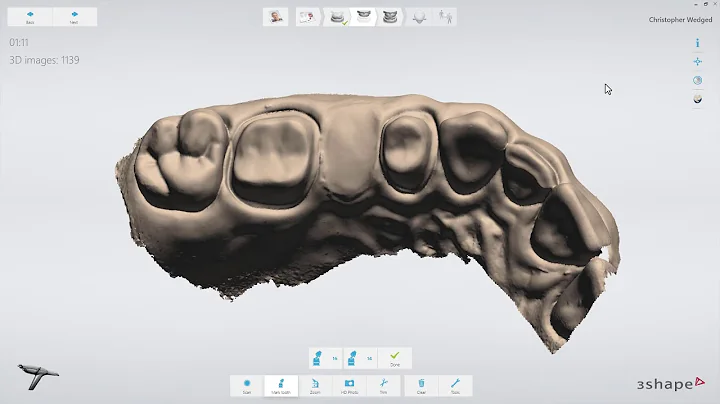 3Shape TRIOS - Bridge Workflow IT