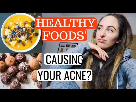 ARE THESE HEALTHY FOODS CAUSING YOUR ACNE?