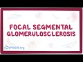 Focal Segmental Glomerulosclerosis - causes, symptoms, diagnosis, treatment, pathology