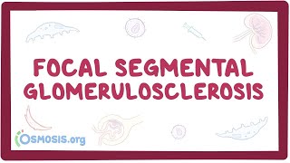 Focal Segmental Glomerulosclerosis  causes, symptoms, diagnosis, treatment, pathology