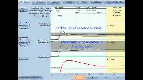 Why Should We Use Devices Such as Navigator and Smart Pilot to Guide Our Anesthetic? by Ross Kennedy