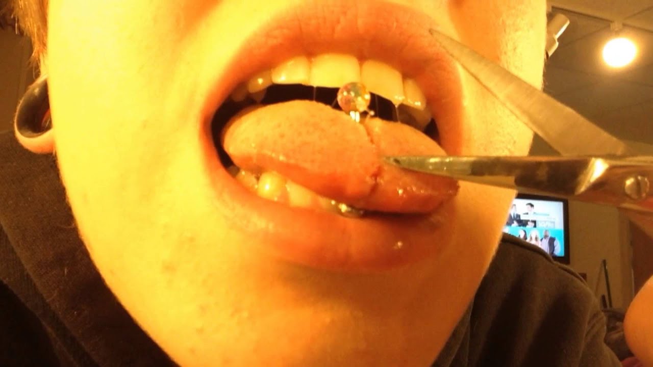 Tongue Splitting Bifurcationday 3 Youtube 