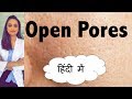 ओपन पॉर्ज़ के कारन और इलाज | open pores| home remedy | हिंदी में | डॉ. आँचल पंत