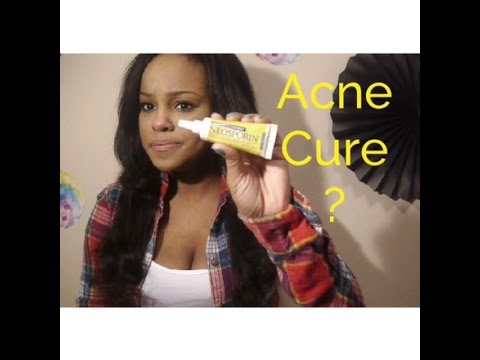 Does Neosporin cure acne overnight? Or Nah?