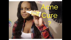 Does Neosporin cure acne overnight? Or Nah?