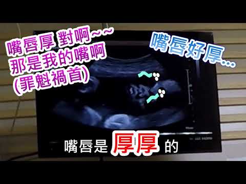 D&Y 寶寶超音波之33週第六次產檢紀錄 [新竹國軍醫院 侯文健醫師 寶寶長好長滿長快 體重破2000克 32週多至33週 孕期紀錄]