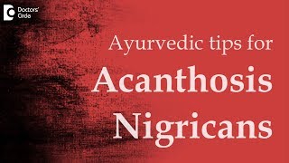 Tips in ayurveda for Acanthosis Nigricans - Dr. Mini Nair