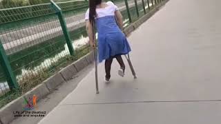 The beautiful woman with polio challenges the disability of walking with crutches #polio