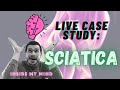 INSIDE MY MIND: Live Sciatica Evaluation &amp; Case Study Breakdown
