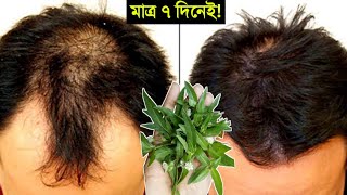 মাত্র ৭ দিনেই টাক মাথায় চুল গজাবে || কালোকেশী গাছের উপকারিতা | লিভার, কিডনি পরিস্কার করে কেশুতি পাতা