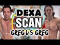 MY DEXA SCAN RESULTS With KINOBODY || Dexa Scan Vs. My Lazer Eyes and Calipers || Greg Vs. Greg