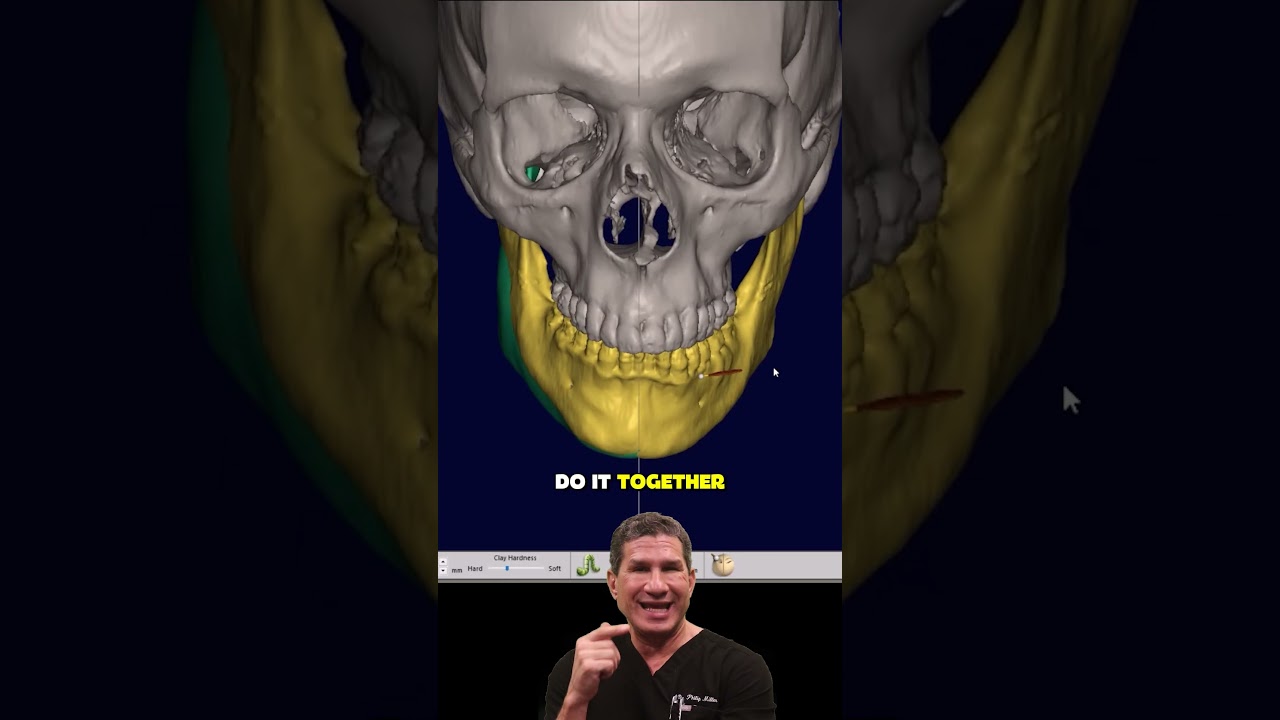 Custom Chin & Jaw Implants | 3D Designed, Virtually Previewed, Perfectly You