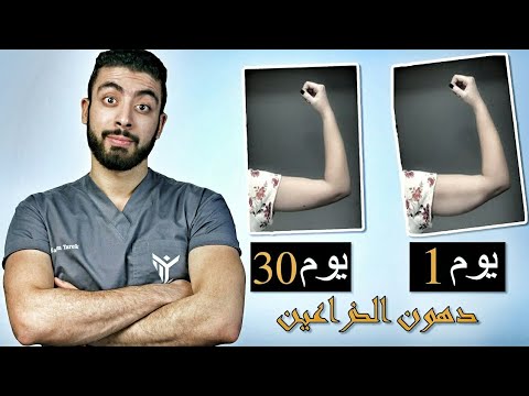 فيديو: هل يمكنك التخلص من شد الذراع؟