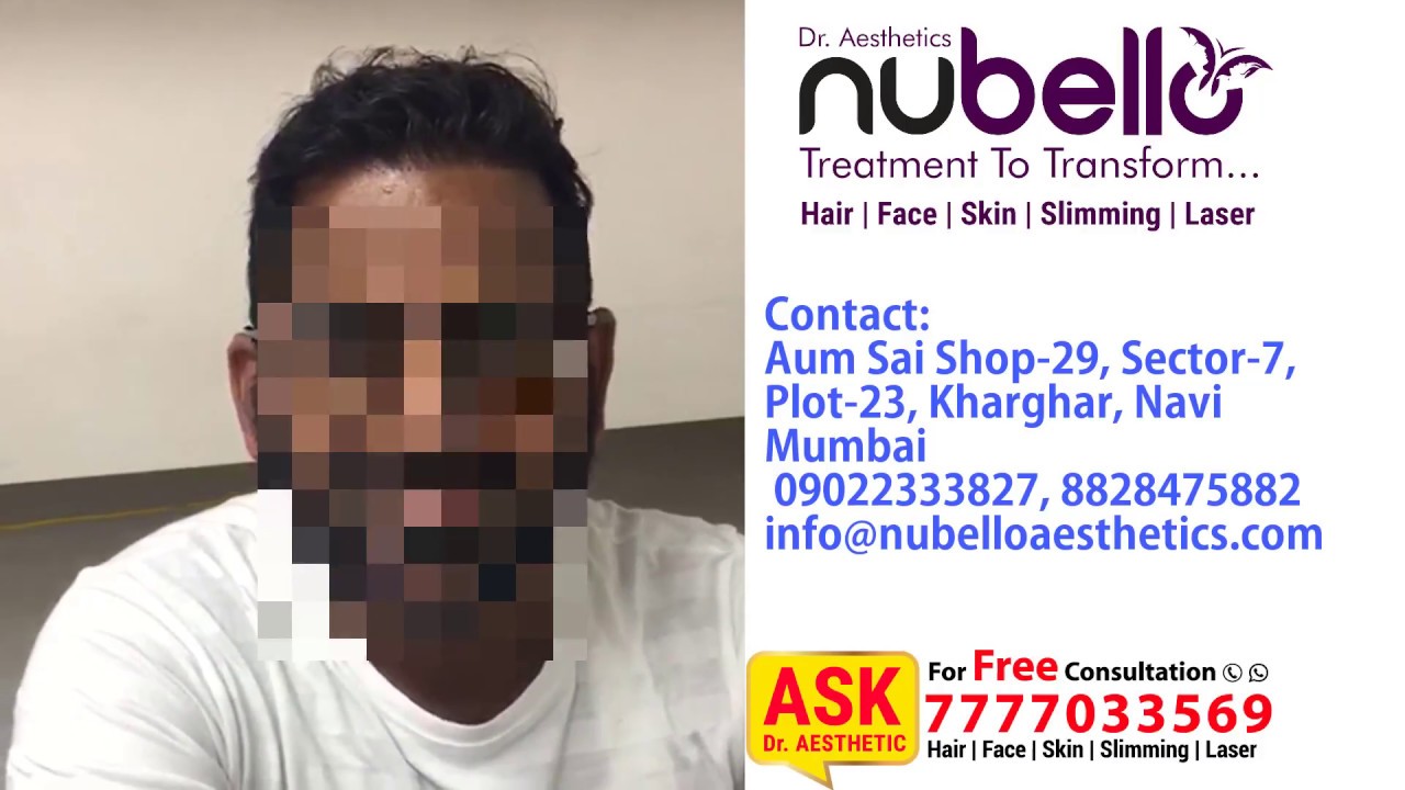 Best Hair Transplant In Navi Mumbai  PVR Aesthetica