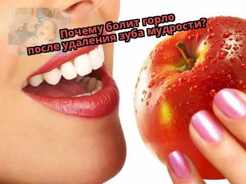 Почему болит горло после удаления зуба мудрости?